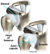 Illustration of a shoulder joint showing labeled parts: glenoid, clavicle, scapula, head of humerus, and joint capsule. Two views display anatomical connections and structures of the shoulder.