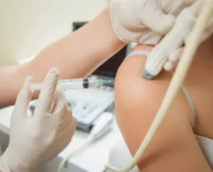 Ultrasound-guided platelet-rich plasma injection